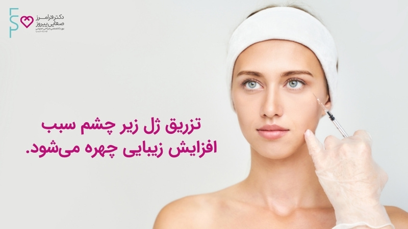 مزایای تزریق ژل زیر چشم 